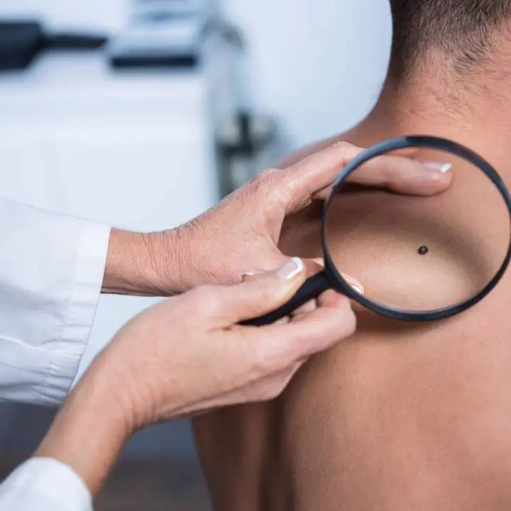 Ηλεκτρονική Χαρτογράφηση Σπίλων - Δερματολογική Φροντίδα