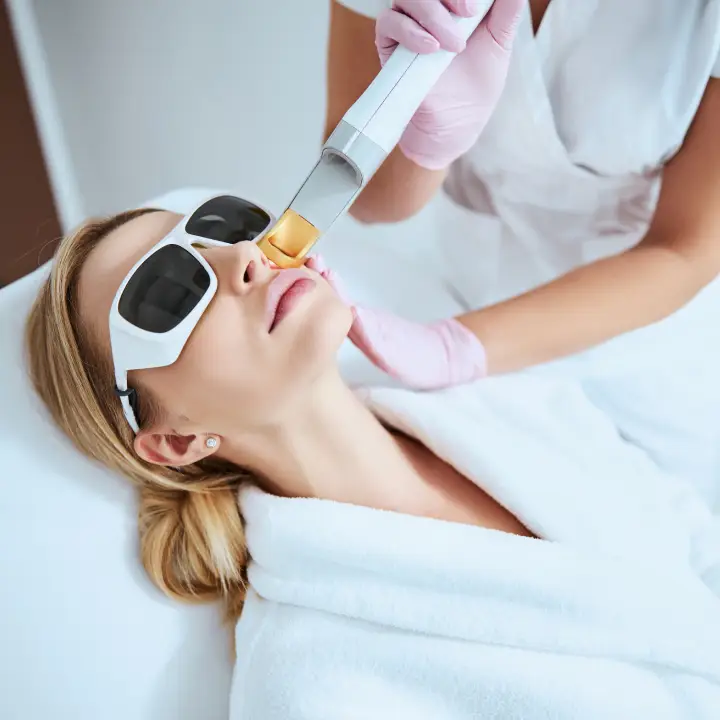 Fractional Laser CO2 Ανάπλαση Δέρματος